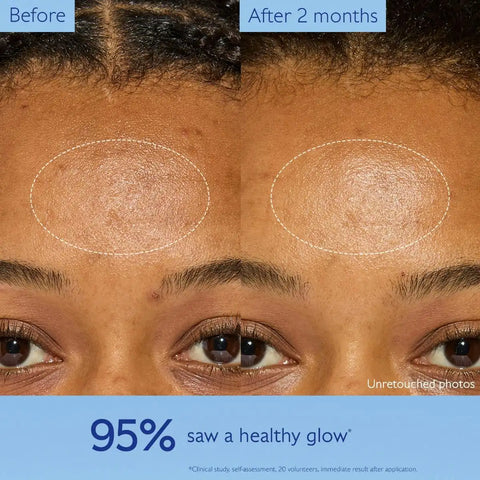 Dark Spot Brightening Moisturizer with Niacinamide