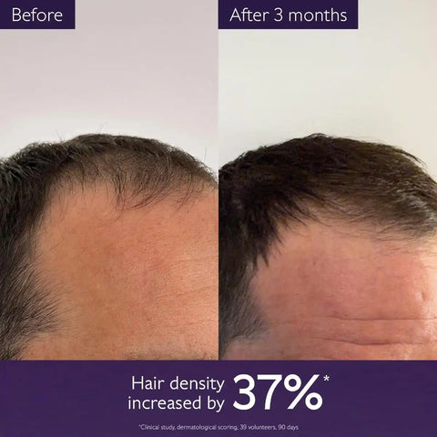 Hair Density Serum